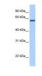 Zinc Finger And BTB Domain Containing 26 antibody, NBP1-80351, Novus Biologicals, Western Blot image 