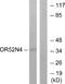 Olfactory Receptor Family 52 Subfamily N Member 4 (Gene/Pseudogene) antibody, A30888, Boster Biological Technology, Western Blot image 