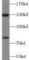 Angiomotin antibody, FNab09852, FineTest, Western Blot image 