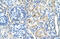 Signal Peptide Peptidase Like 2B antibody, ARP44989_P050, Aviva Systems Biology, Immunohistochemistry frozen image 