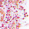 JunB Proto-Oncogene, AP-1 Transcription Factor Subunit antibody, LS-C356138, Lifespan Biosciences, Immunohistochemistry frozen image 