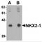 NK2 Homeobox 1 antibody, MBS150900, MyBioSource, Western Blot image 
