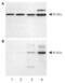 Catenin Beta 1 antibody, ALX-804-060-C100, Enzo Life Sciences, Western Blot image 