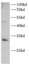 Mitochondrial uncoupling protein 2 antibody, FNab10373, FineTest, Western Blot image 