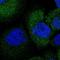 Alpha Tubulin Acetyltransferase 1 antibody, HPA050999, Atlas Antibodies, Immunocytochemistry image 