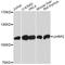 Ubiquitin Like With PHD And Ring Finger Domains 2 antibody, A2344, ABclonal Technology, Western Blot image 