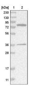 HSD17B4 antibody, NBP1-85295, Novus Biologicals, Western Blot image 