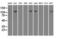 Mitotic checkpoint serine/threonine-protein kinase BUB1 beta antibody, LS-C797086, Lifespan Biosciences, Western Blot image 