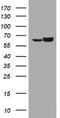 Heat Shock Protein Family D (Hsp60) Member 1 antibody, TA800756BM, Origene, Western Blot image 
