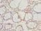 Regulator Of Microtubule Dynamics 1 antibody, A66914-100, Epigentek, Immunohistochemistry paraffin image 