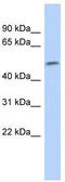 SRY-Box 11 antibody, TA334038, Origene, Western Blot image 