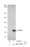 Ubiquitin carboxyl-terminal hydrolase 22 antibody, NBP1-82941, Novus Biologicals, Immunohistochemistry frozen image 