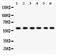 1,25-dihydroxyvitamin D(3) 24-hydroxylase, mitochondrial antibody, PB9547, Boster Biological Technology, Western Blot image 