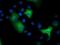 Epoxide Hydrolase 2 antibody, GTX84567, GeneTex, Immunofluorescence image 