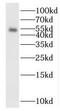 SMAD Family Member 5 antibody, FNab07998, FineTest, Western Blot image 