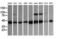 Acetyl-CoA Acyltransferase 2 antibody, LS-B15556, Lifespan Biosciences, Western Blot image 