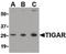 TP53 Induced Glycolysis Regulatory Phosphatase antibody, LS-B1341, Lifespan Biosciences, Western Blot image 