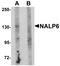 NLR Family Pyrin Domain Containing 6 antibody, LS-C115898, Lifespan Biosciences, Western Blot image 