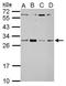 Pre-rRNA-processing protein TSR2 homolog antibody, GTX121118, GeneTex, Western Blot image 