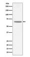 Choline O-Acetyltransferase antibody, M01192, Boster Biological Technology, Western Blot image 