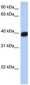 C-X-C Motif Chemokine Receptor 6 antibody, TA330382, Origene, Western Blot image 
