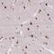 Zinc Finger Protein 672 antibody, NBP2-47563, Novus Biologicals, Immunohistochemistry paraffin image 