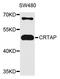 Cartilage-associated protein antibody, orb373228, Biorbyt, Western Blot image 