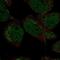 DMRT Like Family A2 antibody, NBP2-57095, Novus Biologicals, Immunocytochemistry image 