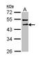 DLTS antibody, LS-C186274, Lifespan Biosciences, Western Blot image 