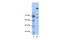 GLI Family Zinc Finger 1 antibody, P100609_T100, Aviva Systems Biology, Western Blot image 