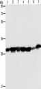 Adenylate kinase 2, mitochondrial antibody, TA349614, Origene, Western Blot image 