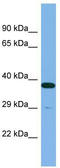 Isobutyryl-CoA dehydrogenase, mitochondrial antibody, TA334527, Origene, Western Blot image 