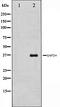 Histone Deacetylase 9 antibody, orb106539, Biorbyt, Western Blot image 