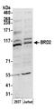 Bromodomain Containing 2 antibody, A300-204A, Bethyl Labs, Western Blot image 