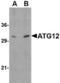 Autophagy Related 12 antibody, TA306511, Origene, Western Blot image 