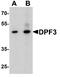 Double PHD Fingers 3 antibody, A09485, Boster Biological Technology, Western Blot image 