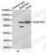 Sequestosome 1 antibody, A0682, ABclonal Technology, Immunoprecipitation image 