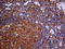 Fermitin family homolog 3 antibody, LS-C794216, Lifespan Biosciences, Immunohistochemistry paraffin image 