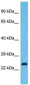 Protein YIPF7 antibody, TA330832, Origene, Western Blot image 