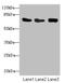Cysteine And Serine Rich Nuclear Protein 2 antibody, LS-C675602, Lifespan Biosciences, Western Blot image 