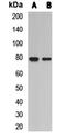 L3MBTL Histone Methyl-Lysine Binding Protein 2 antibody, orb411730, Biorbyt, Western Blot image 
