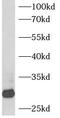B-cell receptor-associated protein 31 antibody, FNab00802, FineTest, Western Blot image 