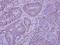 Histone Deacetylase 7 antibody, GTX114179, GeneTex, Immunohistochemistry paraffin image 