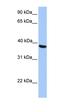 N(Alpha)-Acetyltransferase 80, NatH Catalytic Subunit antibody, orb325411, Biorbyt, Western Blot image 