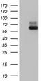 Nuclear receptor ROR-alpha antibody, TA803201BM, Origene, Western Blot image 
