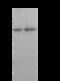 Coagulation Factor IX antibody, GTX01255, GeneTex, Immunoprecipitation image 
