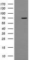 NUMB Endocytic Adaptor Protein antibody, CF501561, Origene, Western Blot image 
