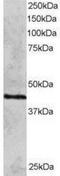DNA repair protein RAD51 homolog 3 antibody, NB100-1127, Novus Biologicals, Western Blot image 