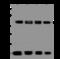 Actinin Alpha 1 antibody, 206333-T36, Sino Biological, Western Blot image 