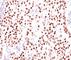 Progesterone Receptor antibody, V7038SAF-100UG, NSJ Bioreagents, Immunohistochemistry paraffin image 